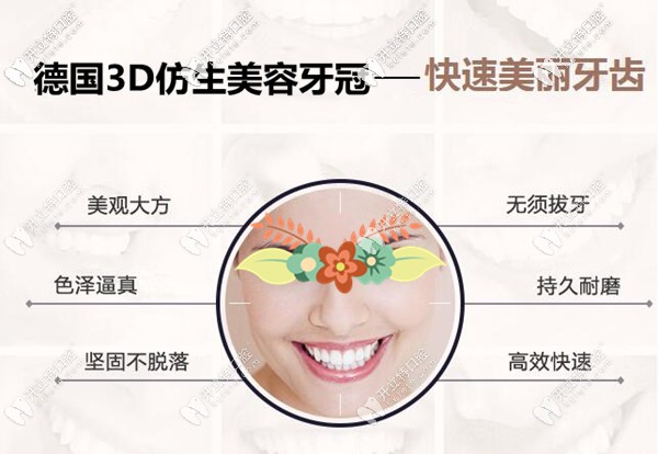 德國3D仿生美容牙冠