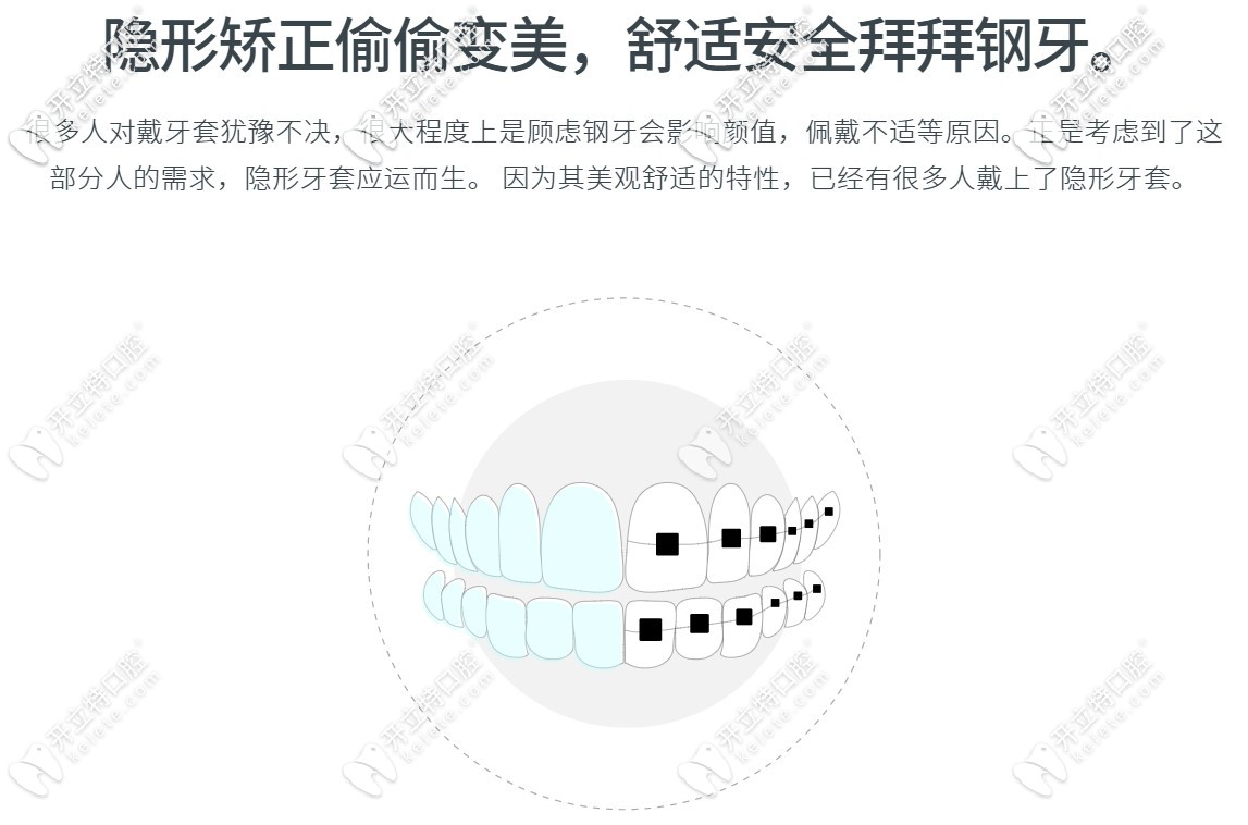 隱形矯正的優(yōu)勢