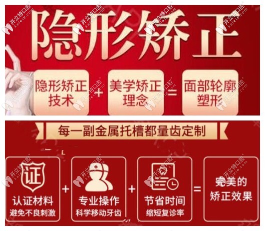 金屬托槽矯正及全隱形矯正的優(yōu)勢(shì)