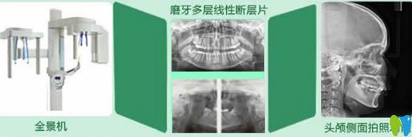 廈門峰煜口腔全套化的高端牙齒診療設備