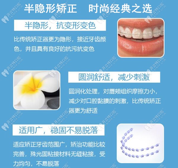 廈門歐菲口腔半隱形陶瓷托槽矯正技術