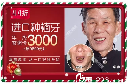 廣州曙光口腔科種植牙3000元附案例