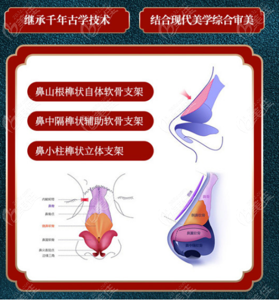 青島諾德醫(yī)學(xué)美容醫(yī)院隆鼻優(yōu)勢(shì)