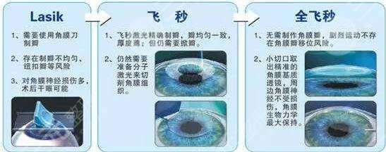 愛爾眼科做近視矯正案例